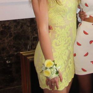 ADORABLE Yellow Lace Mini Dress